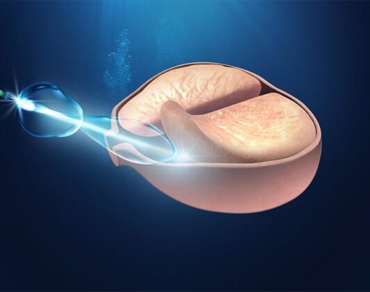 Laser-Holmium-Prostata-min